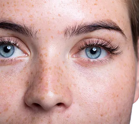 Hydrafacial_Frau_Auge_448x398 Hydrafacial_Frau_Auge_448x398
