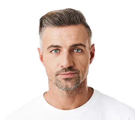 Faltenunterspritzung-mit-Hyaluronsaeure-als-Filler-Mann